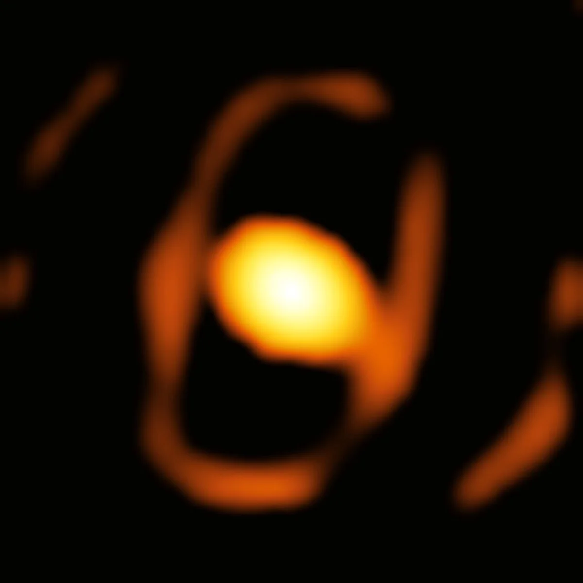 Advancements in Stellar Imaging: WOH G64 and the Frontiers of Astronomy